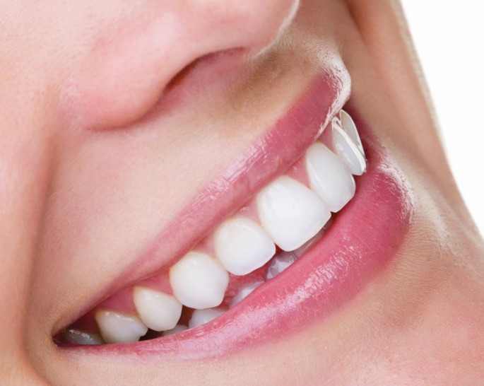 teeth whitening in Tonbridge - teeth bleaching in Tonbridge